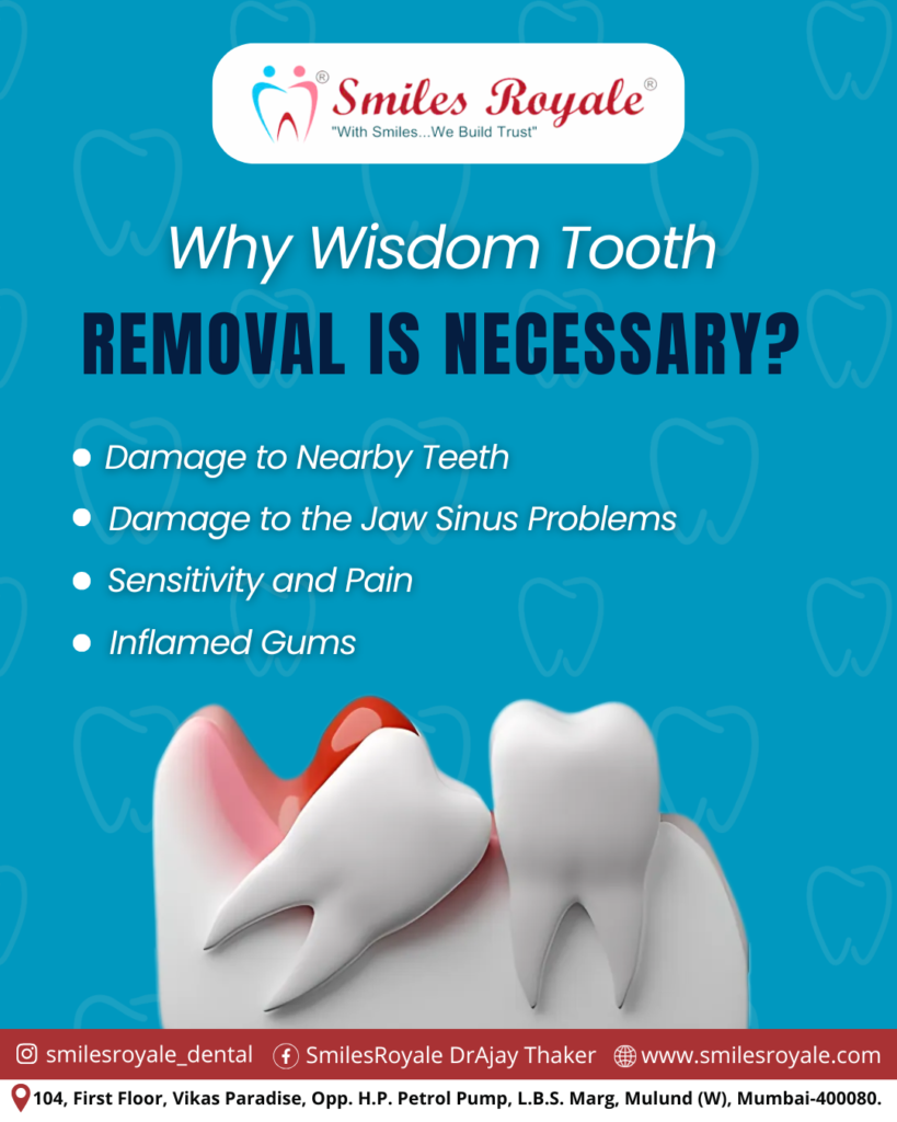 Still holding onto that painful wisdom tooth?