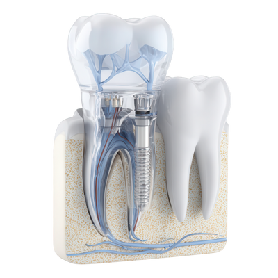Apicoectomy and Surgical Endodontics