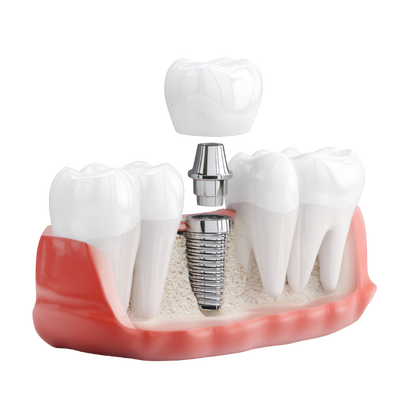 Retreatment and Complex Cases